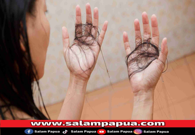 7 Cara Mengatasi Rambut Rontok Berlebihan Dan Solusinya!