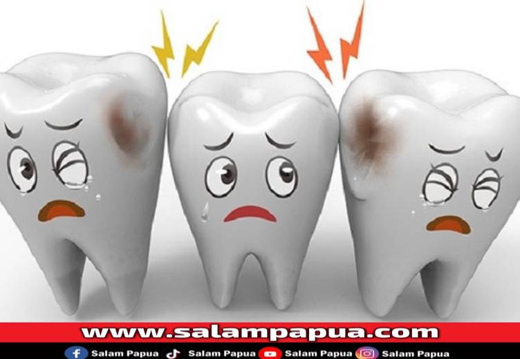 7 Bahaya Gigi Berlubang Jika Tidak Segera Diobati
