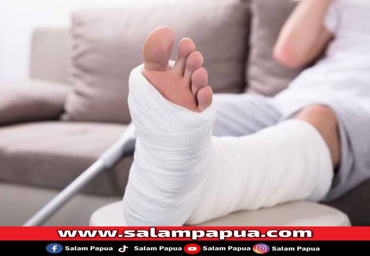 Cara Melakukan Pertolongan Pertama Pada Patah Tulang