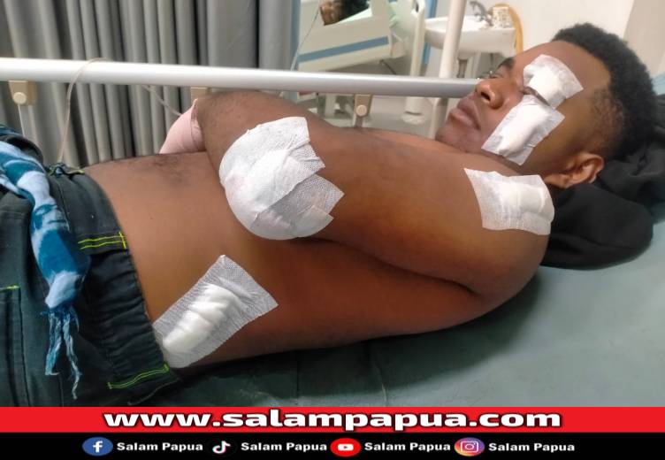 Petugas Kebersihan DLH Mimika Ditebas Pria Mabuk, Begini Kronologinya