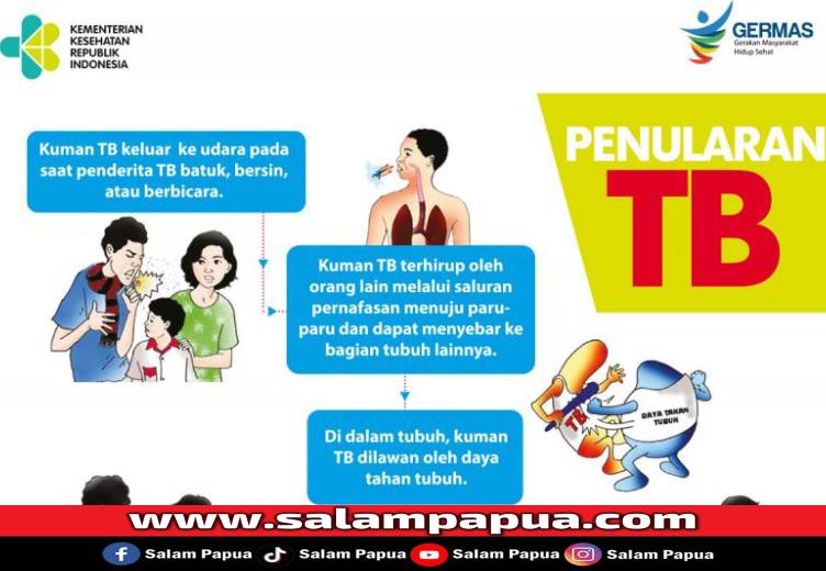 Waspada Bahaya TB Paru Di Permukiman Padat: Ancaman Kesehatan Yang Nyata