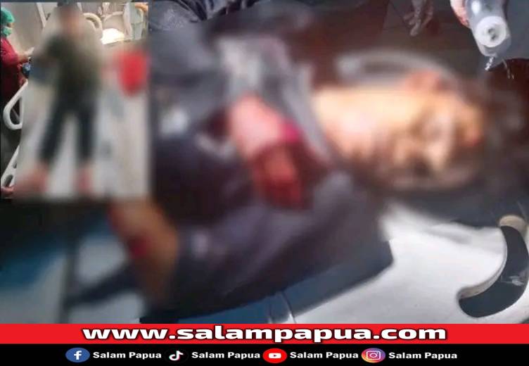 Aksi Sadis Di Nabire, Dua Warga Jadi Korban Pembacokan Tengah Malam