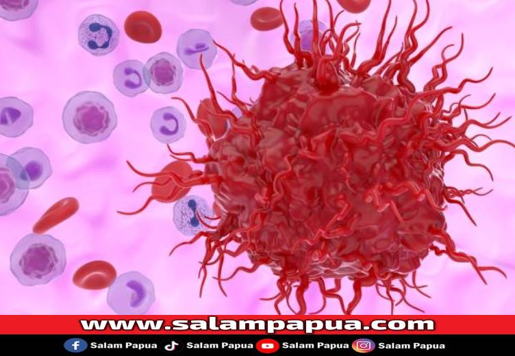 Kanker Neuroendokrin, Ketahui Gejala, Penyebab, Dan Penanganannya