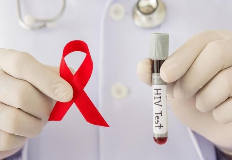 Angka HIV Di Mimika Turun Urutan Ke-6 Se-Papua