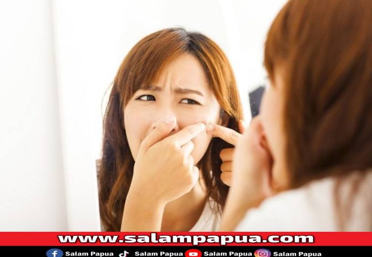 Jerawat Batu, Penyebab Dan Cara Efektif Menghilangkannya