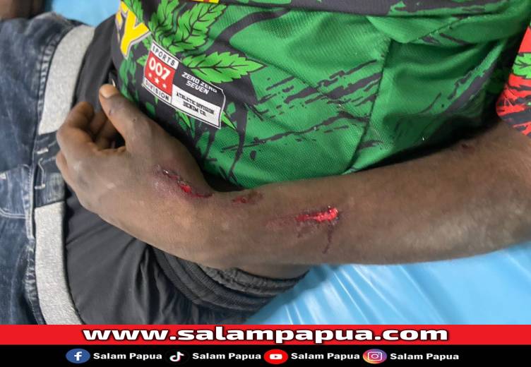 Detik-Detik Kecelakaan Di Yos Sudarso, Begini Kronologinya