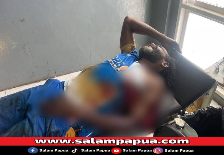 Seorang Warga Tewas Diberondong Tembakan KKB Di Nabire, Empat Orang Luka Berat