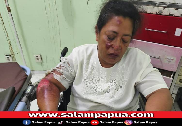 Pelaku Diduga Mabuk, Jemaat GPdI Kalvari SP3 Timika Jadi Korban Tabrak Lari Di SP2