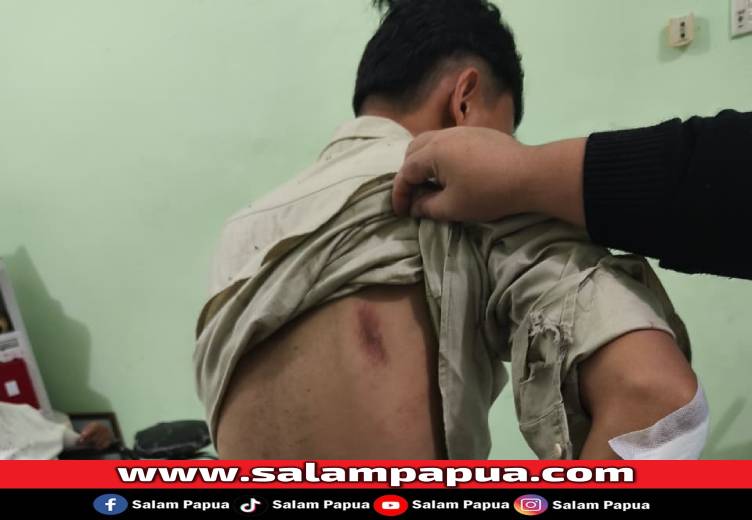 Kondisi badan Enya setelah alami kecelakaan oleh pelaku yang diduga mabuk di kawasan SP2 Timika, Kamis (1/1/2026) pagi (Dokumen Pribadi)
