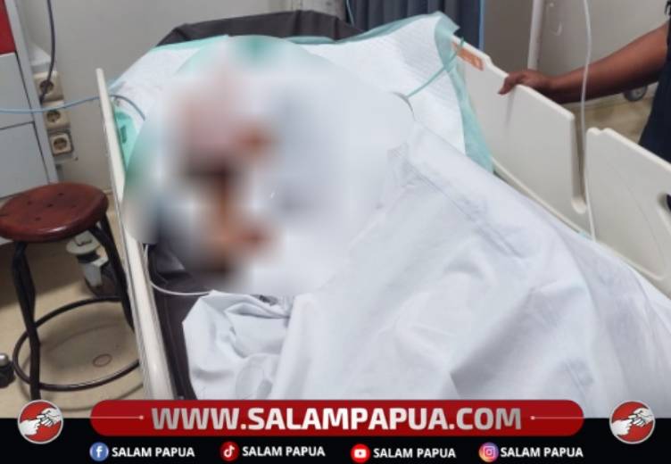 Terlibat Perkelahian, Warga Kwamki Baru Dilarikan Ke RSUD Mimika
