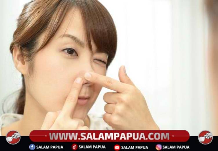 5 Cara Mengatasi Komedo Putih Agar Kulit Wajah Bersih Dan Berseri