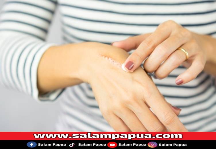 Tangan Kena Minyak Panas, Begini Pertolongan Pertamanya Agar Luka Cepat Sembuh