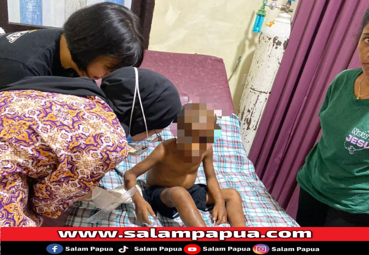 Sepasang Pasutri Dipolisikan Akibat Aniaya Anak Umur 5 Tahun Di Organda Padang Bulan