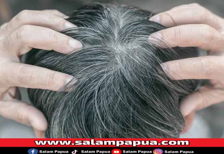 Berikut 7 Penyebab Uban Muncul Di Kepala